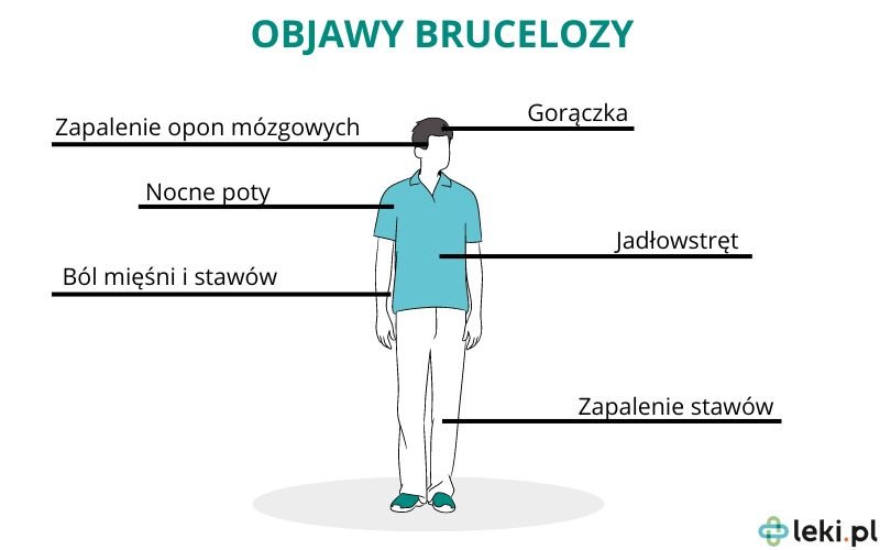 Co to jest bruceloza objawy?