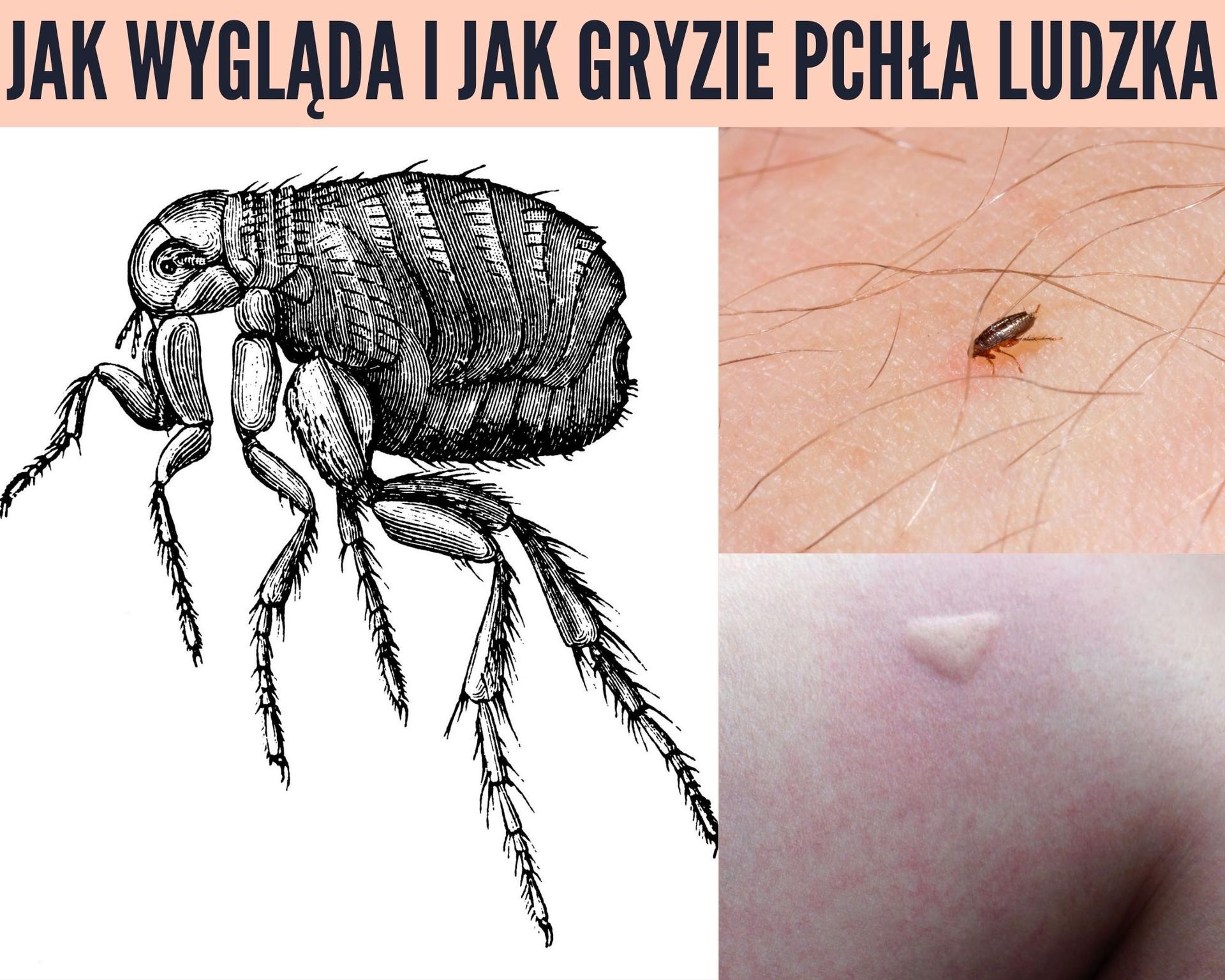 Czy pchła może żyć na człowieku?