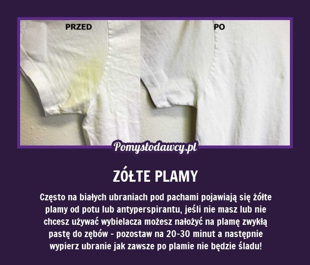 Jak pozbyć się żółtych plam z majtek?