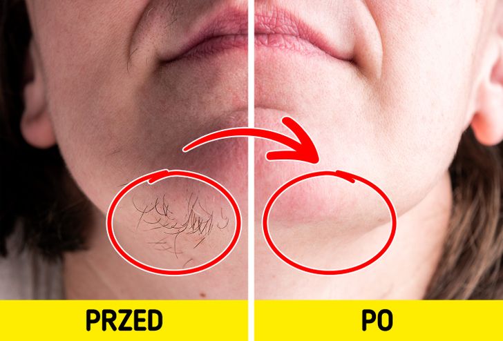Jak naturalnie usunąć owłosienie?