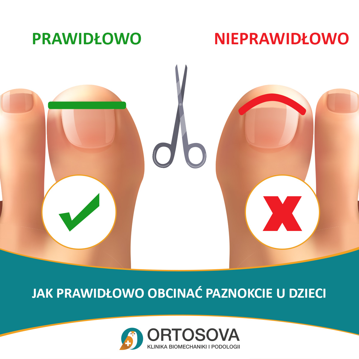 Jak powinno się obcinać paznokcie?
