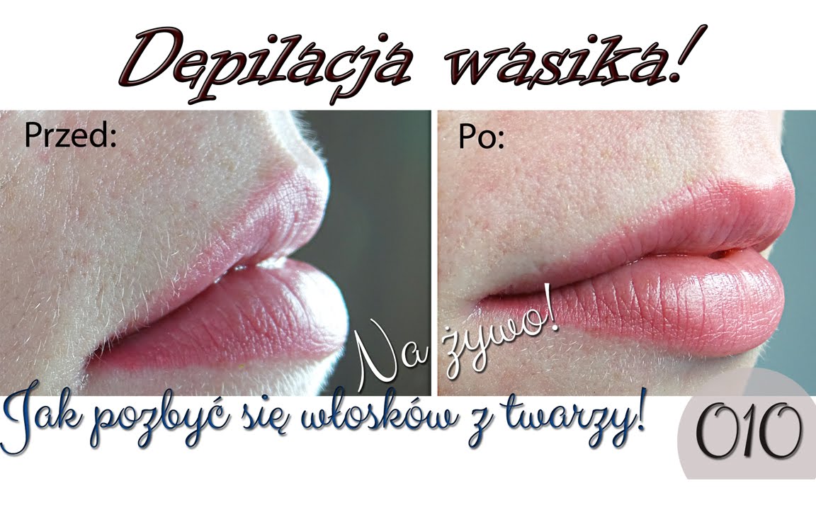 Jak się pozbyć wąsika na twarzy?