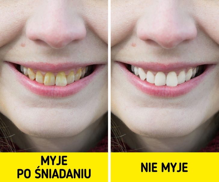 Co się dzieje kiedy nie myjemy zębów?