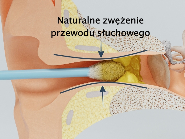 Jak wyczyścić uszy w środku?