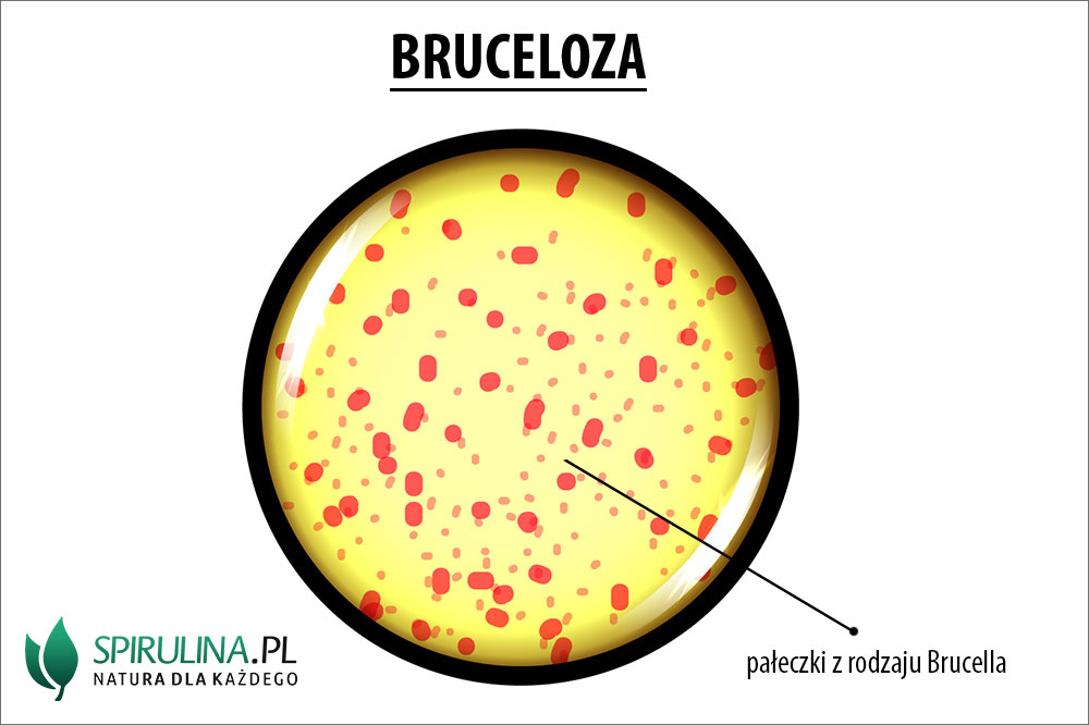 Co wywoluje bruceloza?