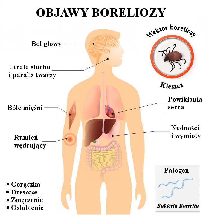 Co zabija krętki boreliozy?