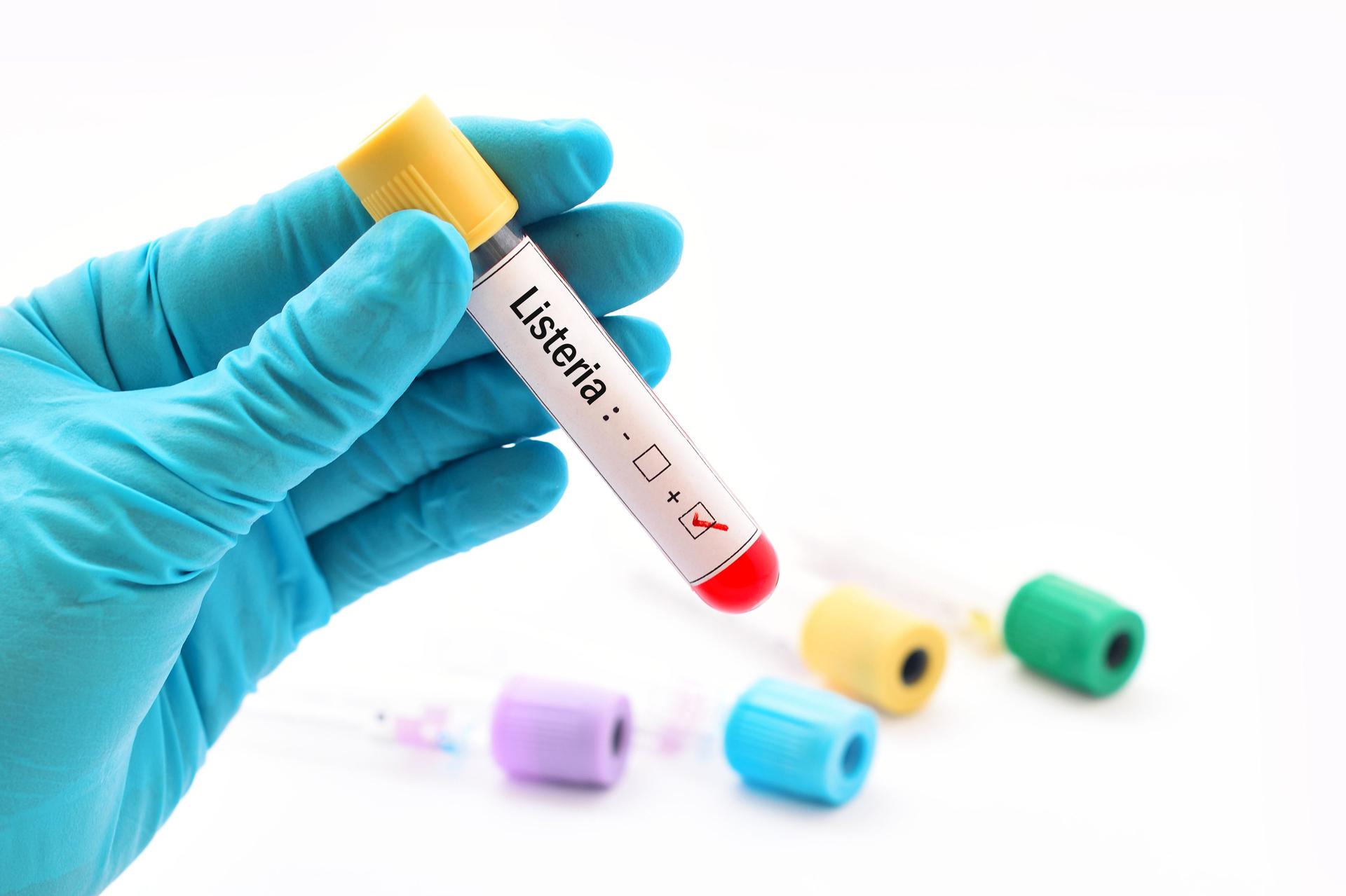 Czy Listeria jest groźna?