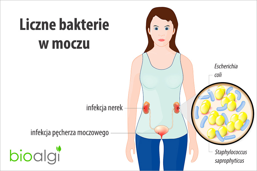 Ile bakterii w moczu to dużo?