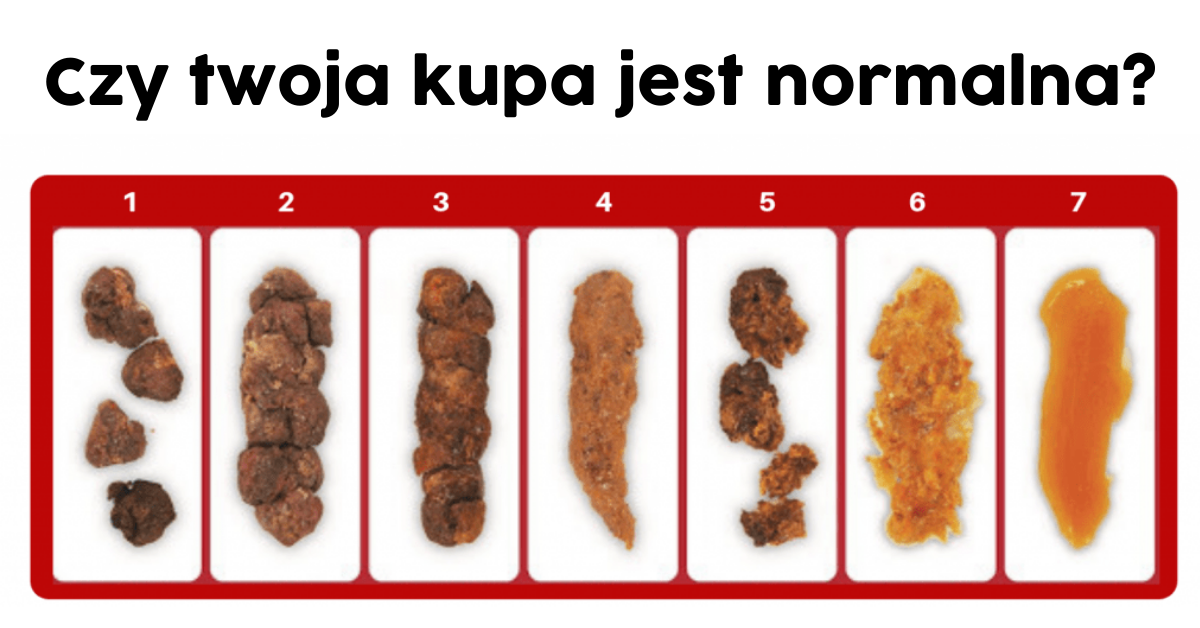 Jaka kupa przy Pasozytach?