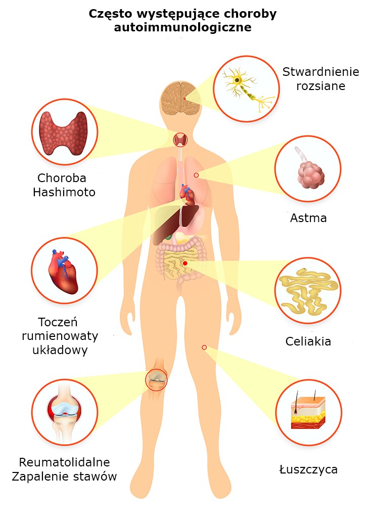 Jakie są rodzaje chorób?