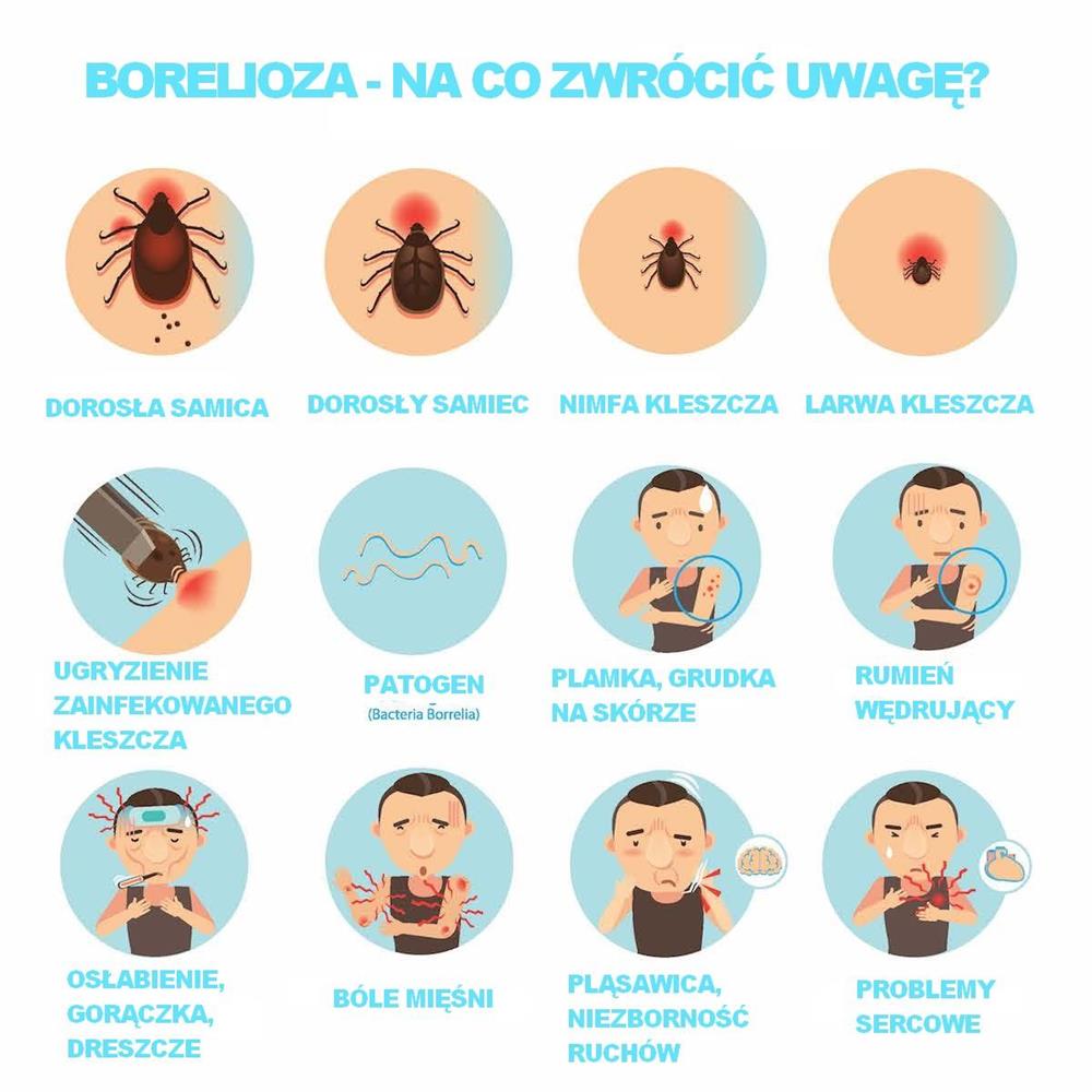 Kiedy wiadomo że jest borelioza?